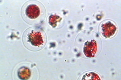 Haematococcus pluvialis (Blutregenalge) als Verursacher einer Vegetationsfärbung Lichtmikroskopische Aufnahme der Blutregenalge Haematococcus pluvialis