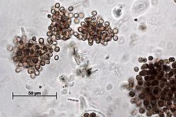 Übersichtsbild Cyanobakterien - Microcystis-Kolonie Lichtmikroskopische Aufnahme mehrerer Zellkolonien von Cyanobakterien der Gattung Microcystis